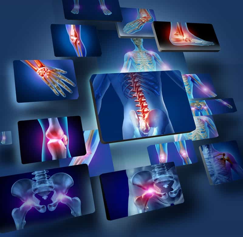 Pain Points Treatable With Nerve Blocks